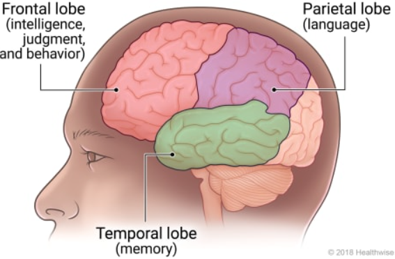 How Dementia Affects The Brain