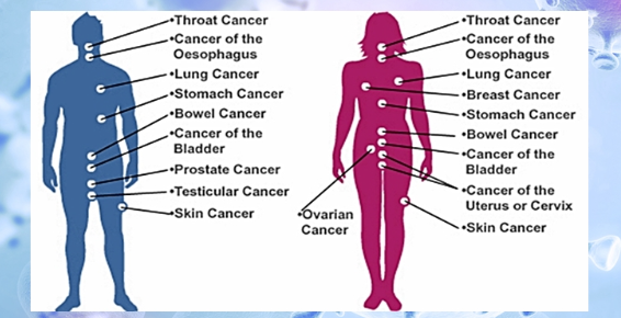Cancer